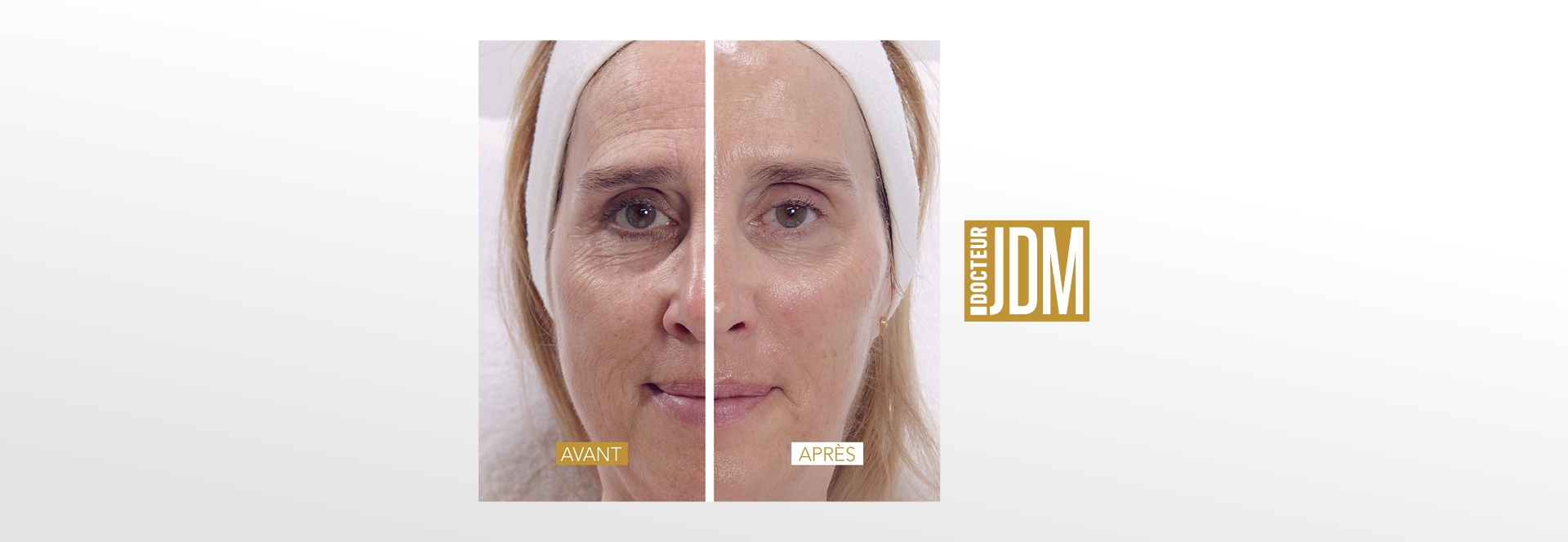 Tratamiento Visible Age Reverse creado por el Dr. JDM