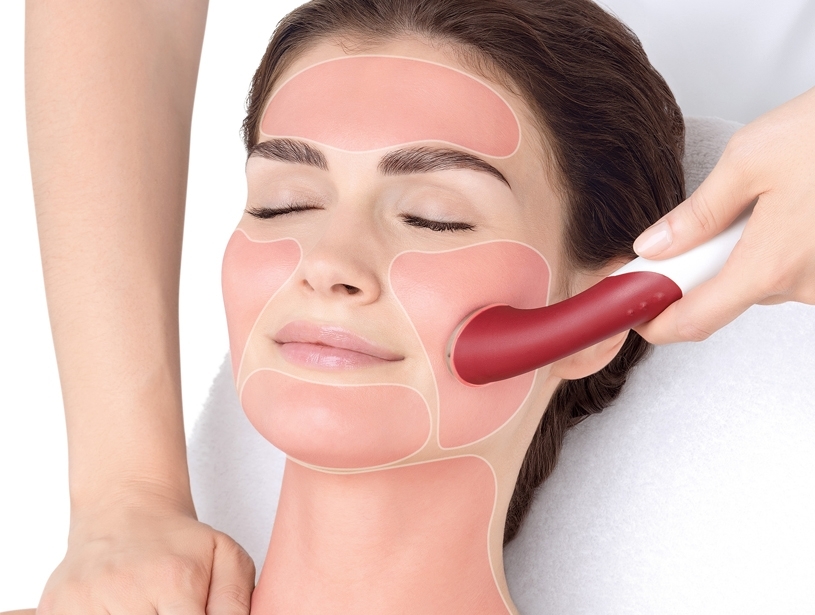 APLICACIÓN DEL SUERO VITALURÓNICO